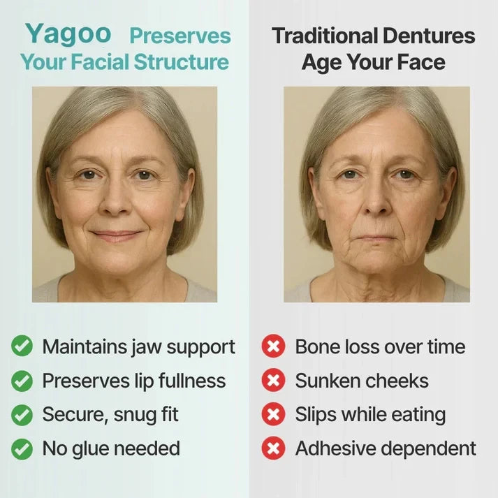 🦷 Yagoo™ Medical Full Dentures | Secure fit and no slippage, recreating the chewing experience of natural teeth!
